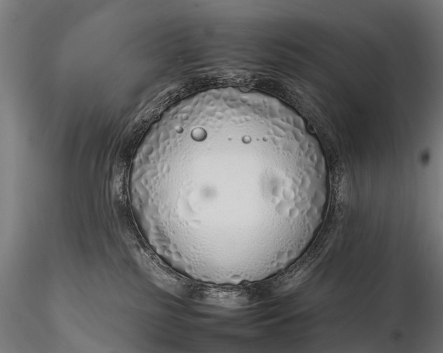 X0000115620185200912011623