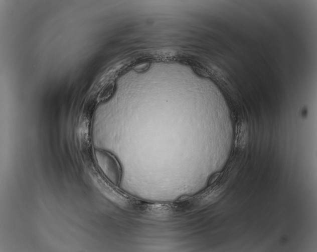 X0000115620238200912011622