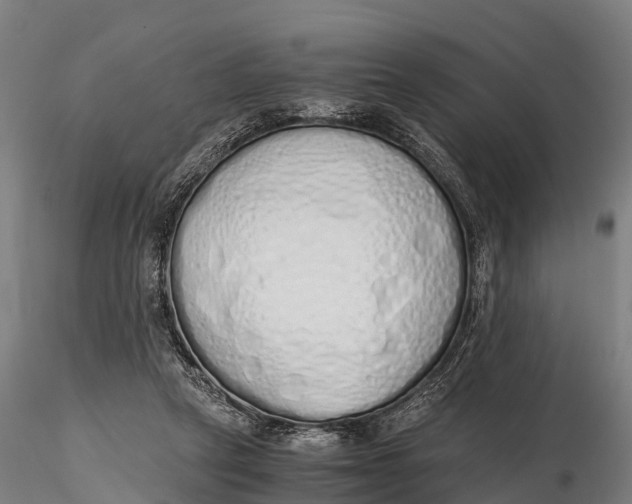 X0000115620257200912011621