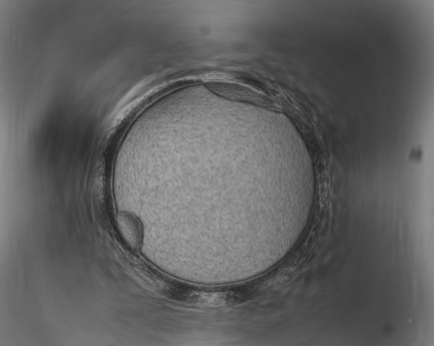 X0000115620295200912011621