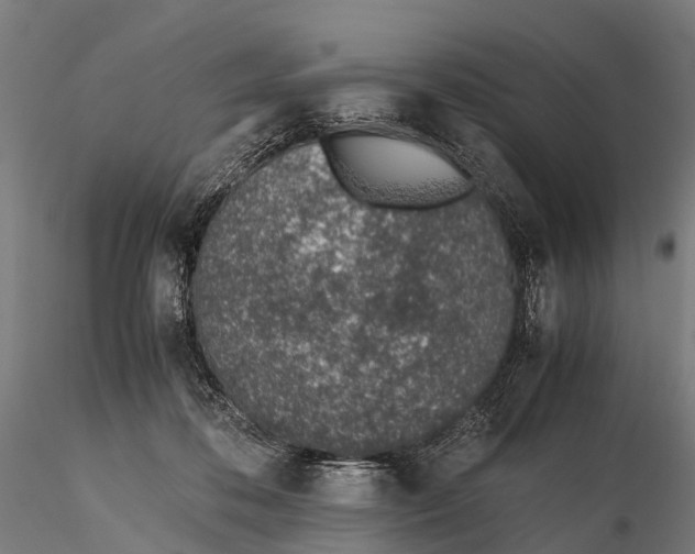 X0000115620316200912011620