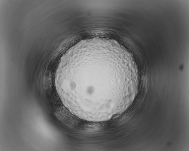 X0000115620381200912011620