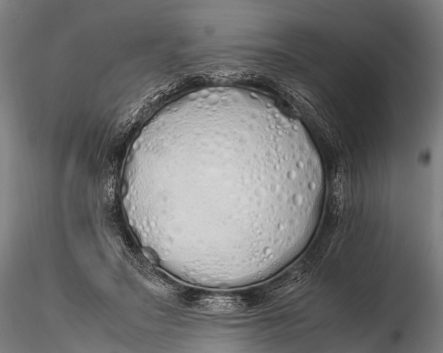 X0000115620499200912011618