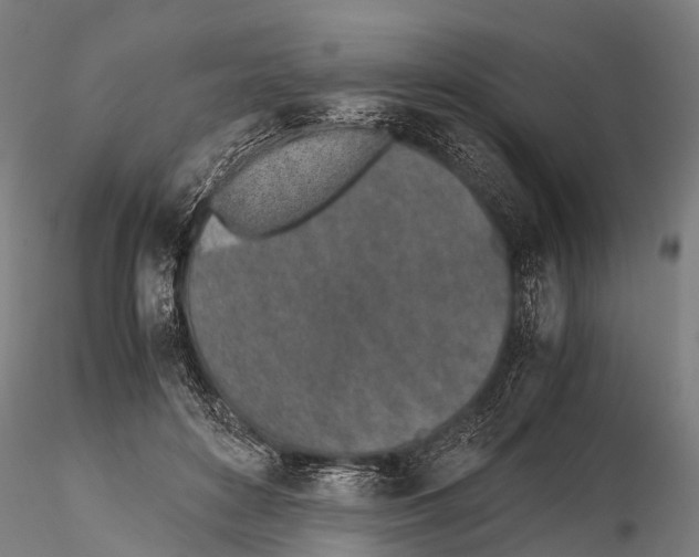 X0000115620504200912011618