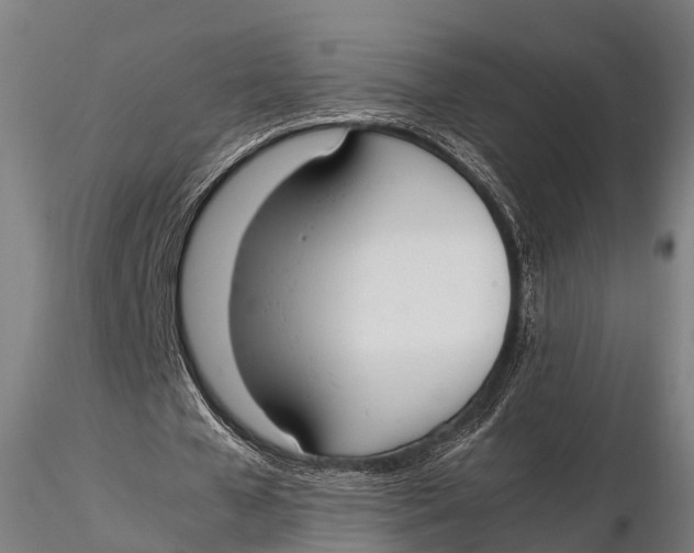 X0000115620577200912011617