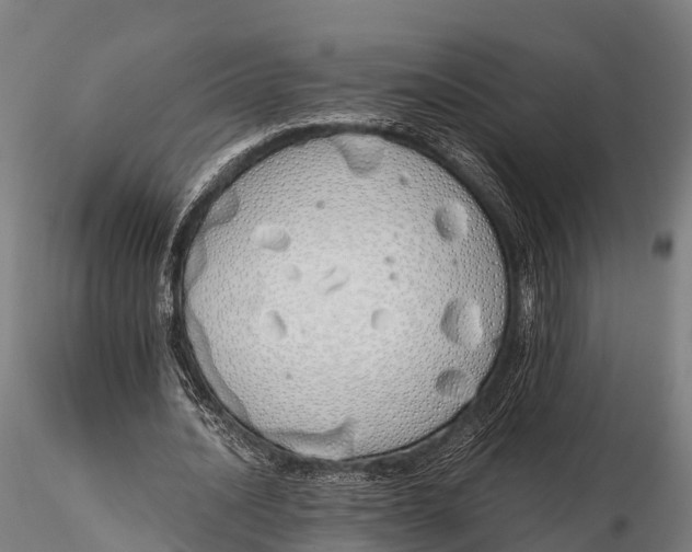 X0000115620628200912011615