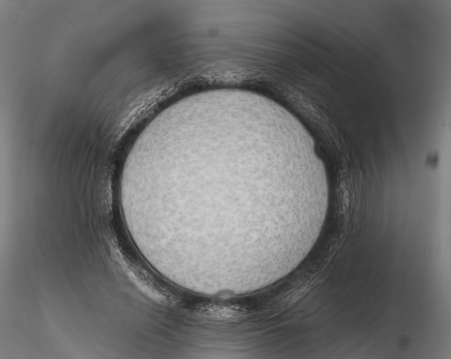 X0000115620638200912011615