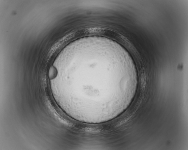 X0000115620725200912011614