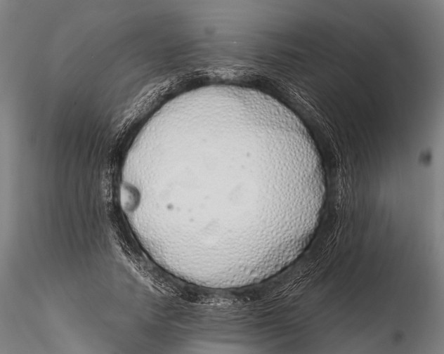 X0000115620738200912011614