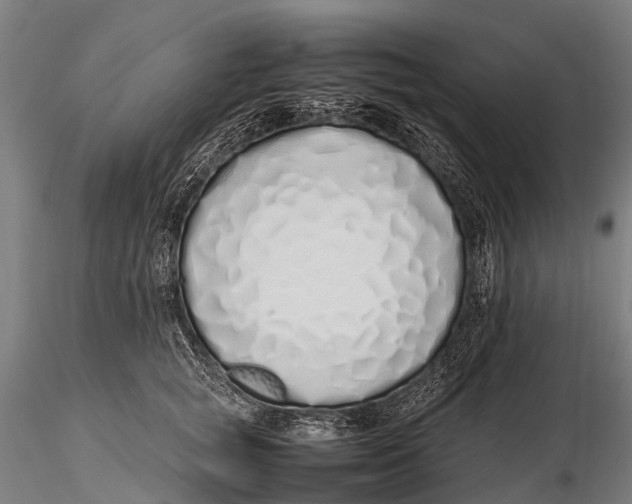 X0000115620757200912011614