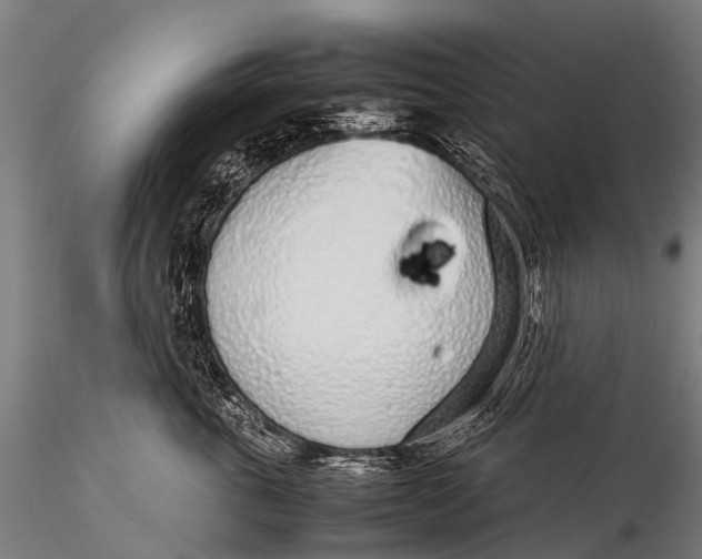 X0000115620763200912011614