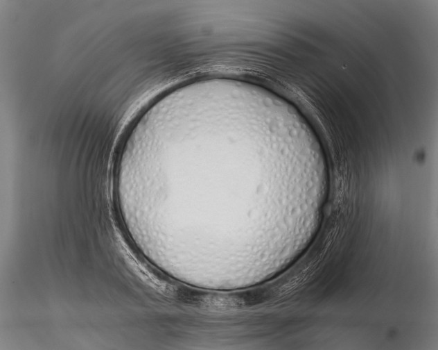 X0000115620795200912011613