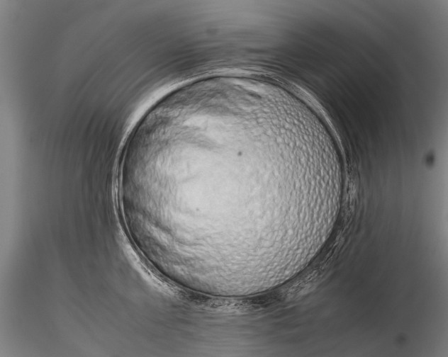 X0000115620811200912011613