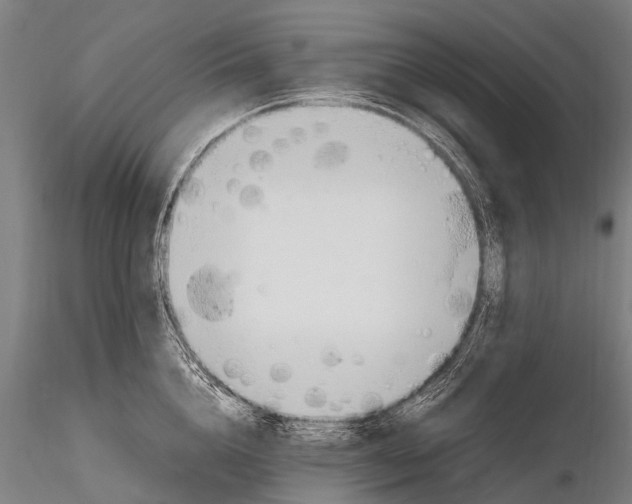 X0000115620856200912011613