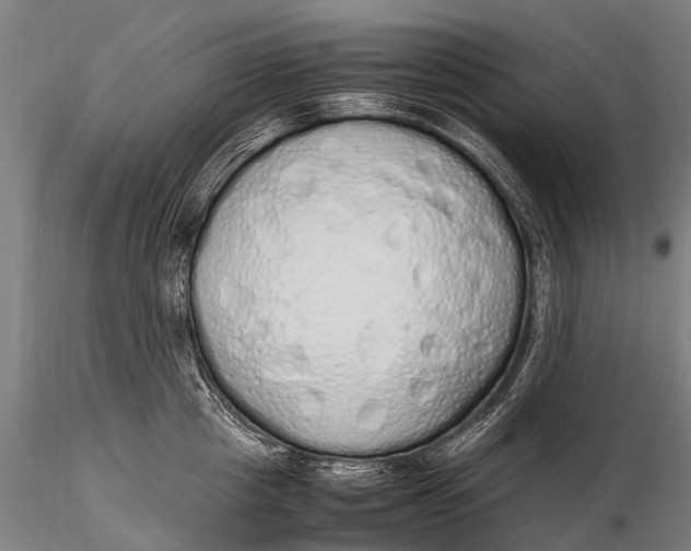 X0000115620857200912011613