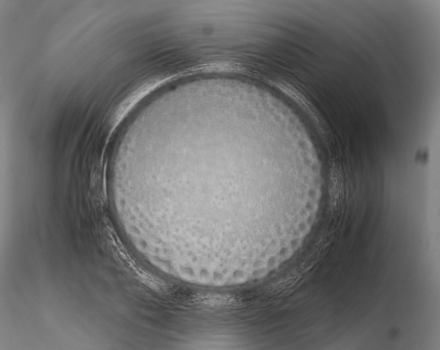 X0000115620886200912011612