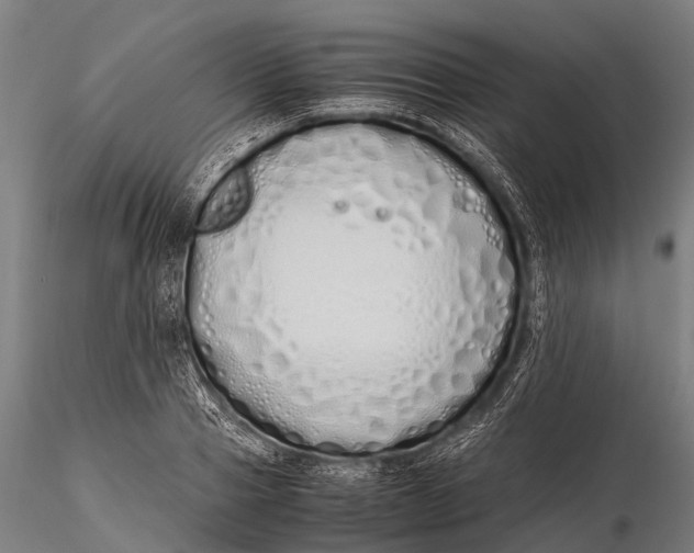 X0000115620937200912011611