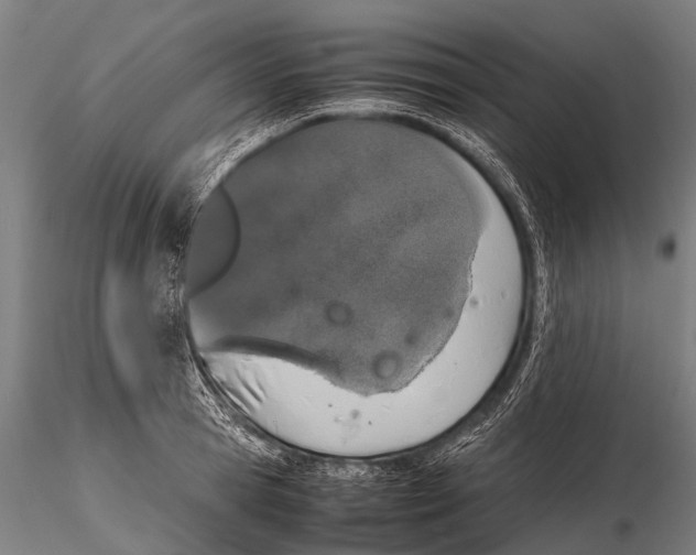 X0000115620945200912011611