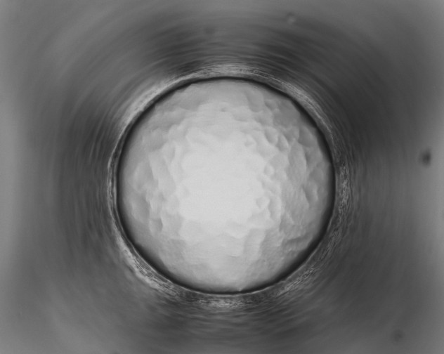 X0000115621047200912011610