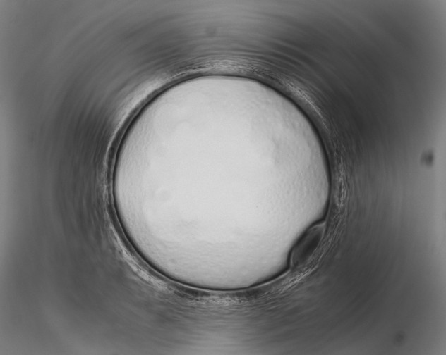 X0000115621087200912011609