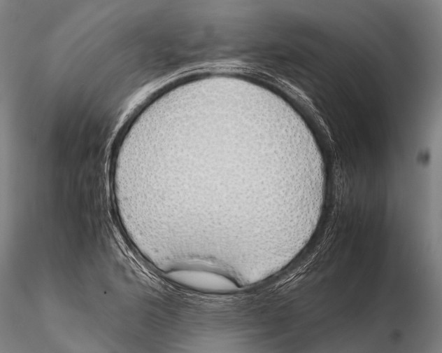 X0000115621176200912011607