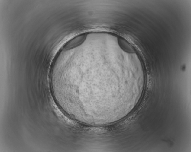 X0000115621189200912011607