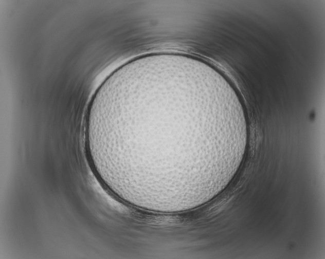 X0000115621387200912011604