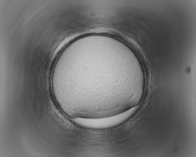 X0000115621412200912011604