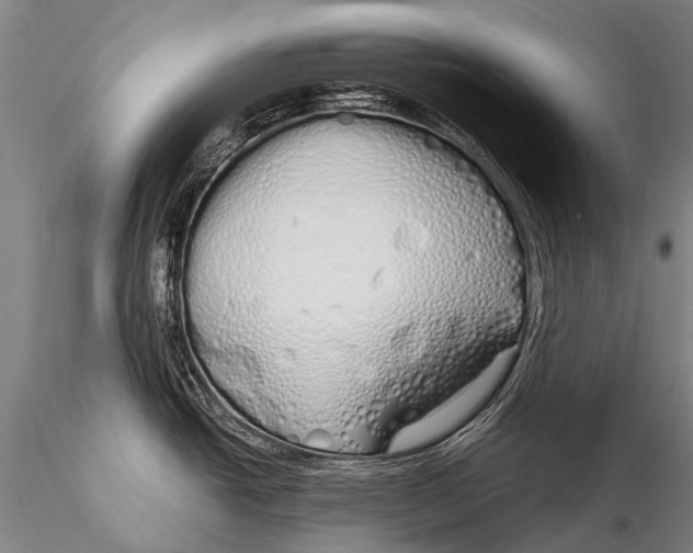 X0000115621438200912011604