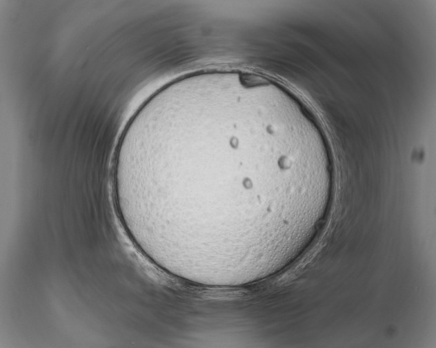 X0000115621440200912011604