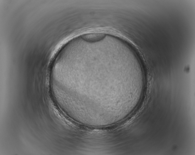 X0000115621506200912011602