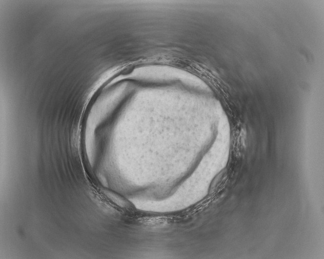 X0000115620100200912081031