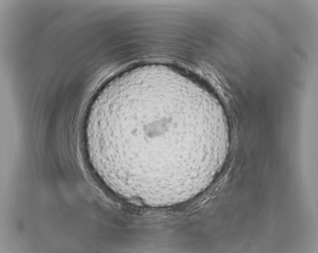 X0000115620145200912081030