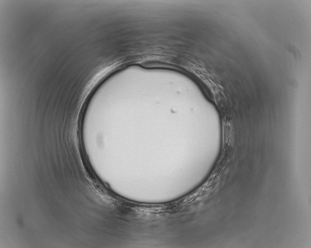 X0000115620147200912081030