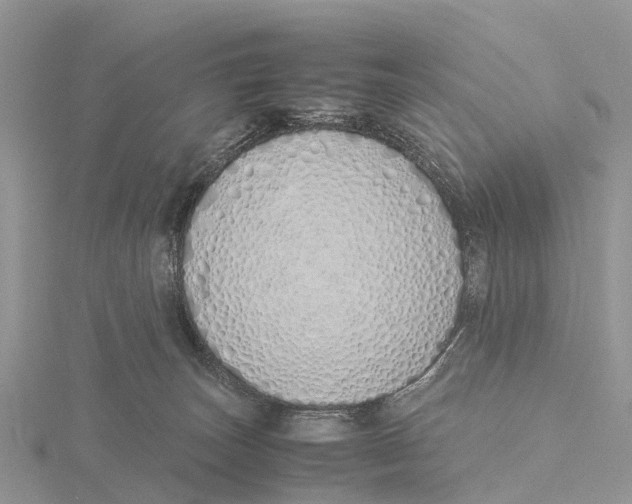 X0000115620179200912081030