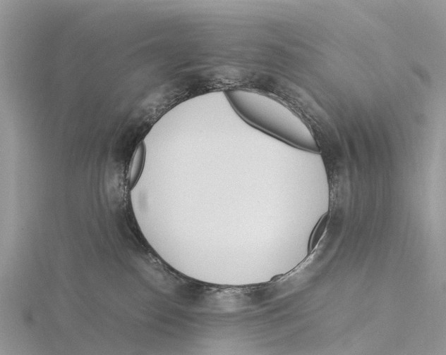 X0000115620186200912081030