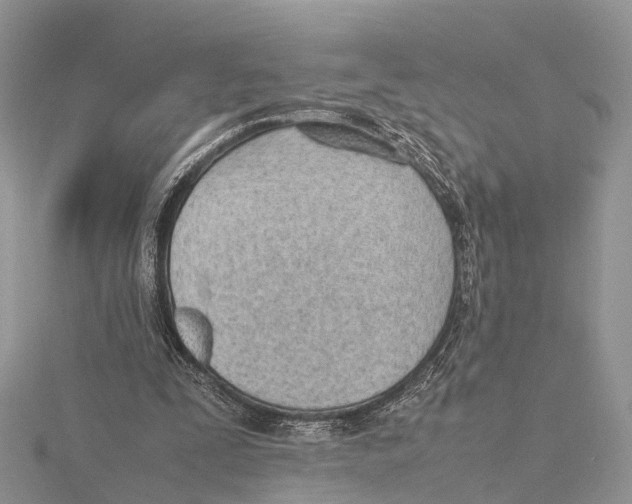 X0000115620295200912081029