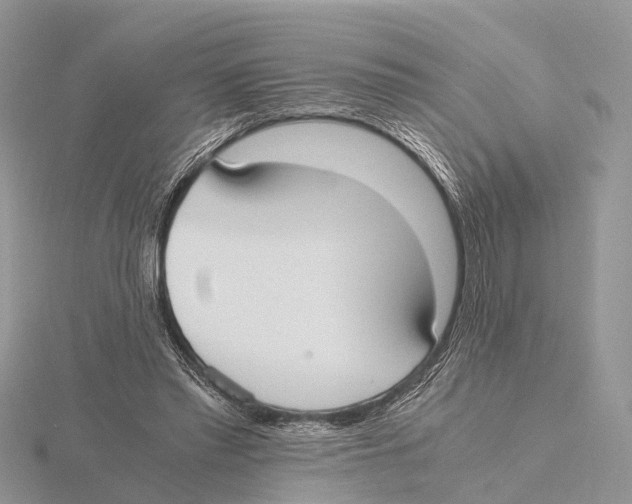 X0000115620397200912081027