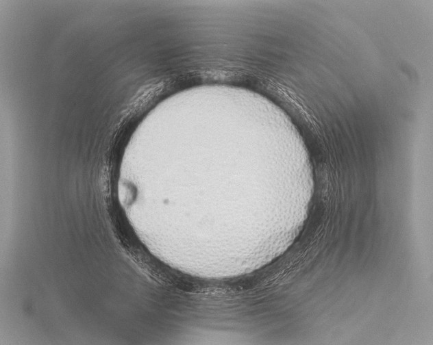 X0000115620738200912081023