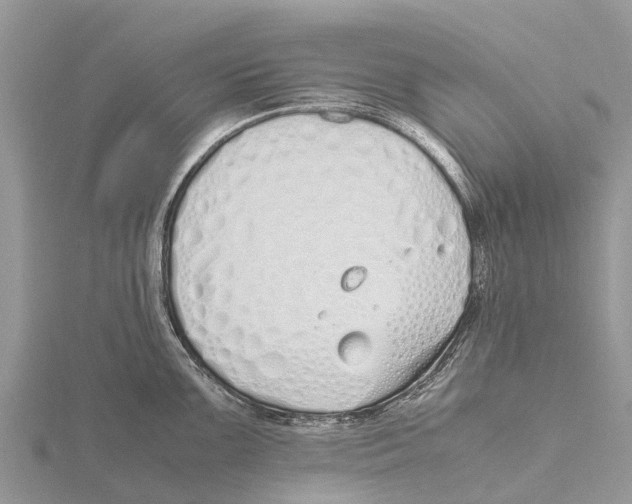 X0000115621099200912081018