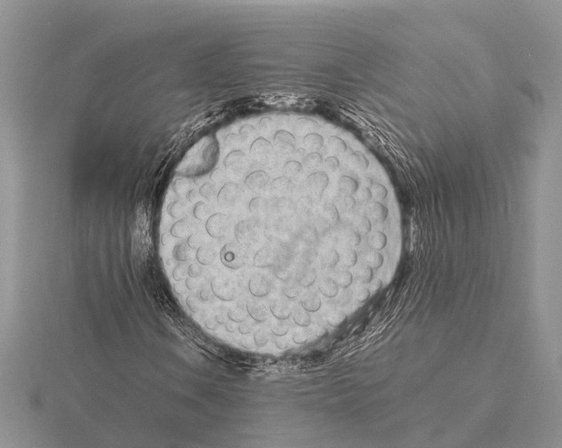 X0000115621106200912081017