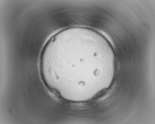 X0000115621149200912081018