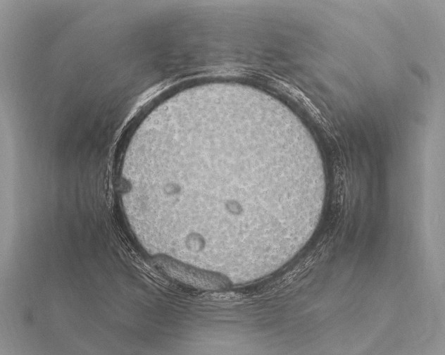 X0000115621168200912081017