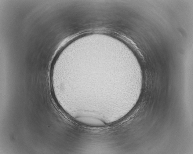 X0000115621176200912081017