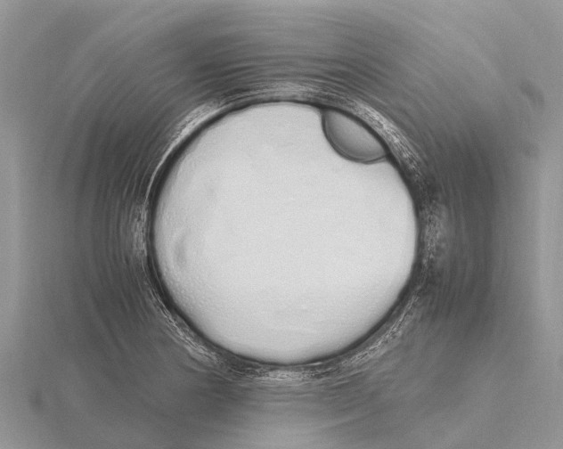 X0000115621178200912081017