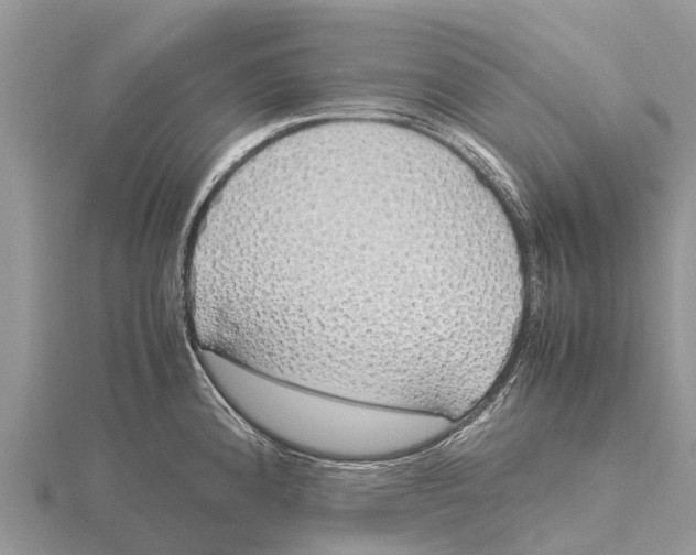 X0000115621192200912081017