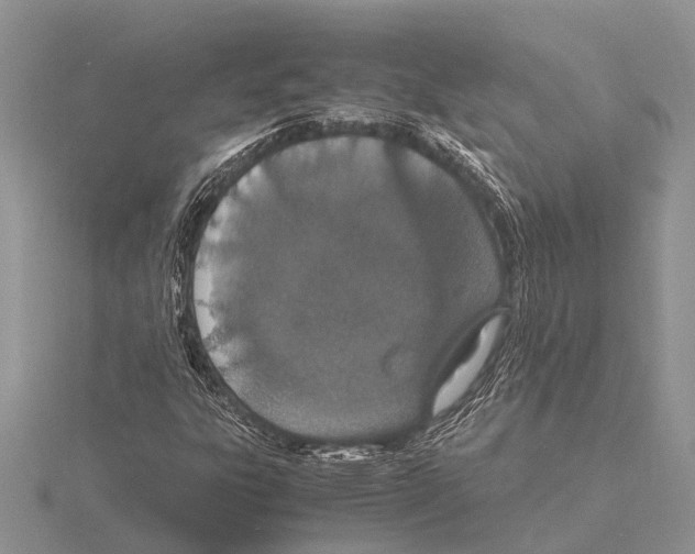 X0000115621303200912081015