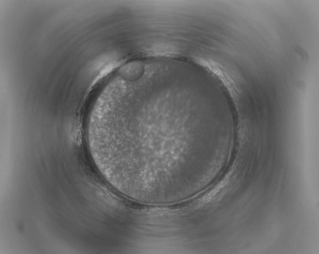 X0000115621306200912081015