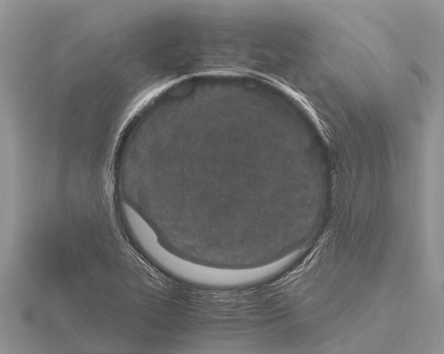 X0000115621319200912081015