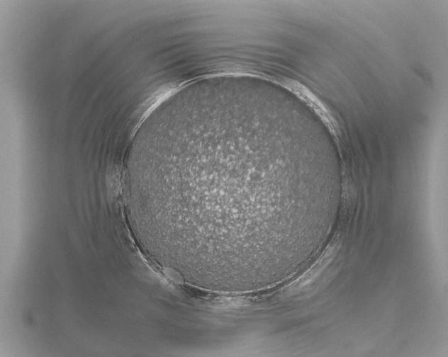 X0000115621385200912081014